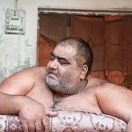 Under treatment obese man – Noor Hassan passes away in Lahore