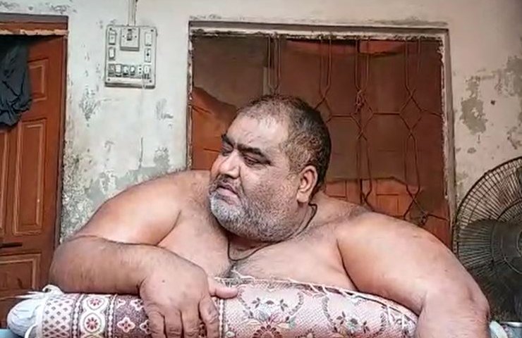 Under treatment obese man – Noor Hassan passes away in Lahore